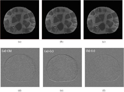 MR images of a mixed sausage without the beam (a), with energized beam line magnets (b), and during proton irradiation at 215 MeV (c). Difference images (d-f) show a submillimeter uniform shift in (vertical) frequency-encoding direction. Images courtesy of Physics in Medicine & Biology, 10.1088/1361-6560/aaece8.