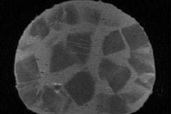 2018 12 20 18 16 0342 2018 12 21 Mri Photon Therapy 20181220184236