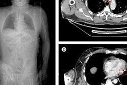 2018 12 21 23 05 1386 Lancet Hunting Accident 20181221231751