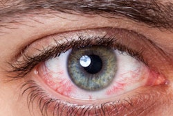 2016 12 21 11 47 35 520 Eye2 400