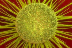 2017 10 26 18 32 2756 Cancer Cell Yellow 400