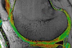 2018 12 21 00 21 4128 2019 01 02 Osteoarthritis3 20181221002644