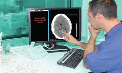 AI promises to relieve the pressure on clinical radiologists.