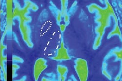 2019 01 07 22 35 7528 Gbca T1 Maps Saake Rad 20190107222017