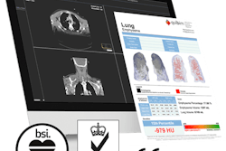 2019 01 14 19 03 8543 Quibim Precision 20190114192522