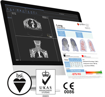 Precision image analysis platform. Image courtesy of QUIBIM.