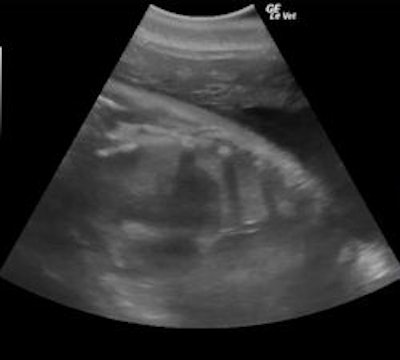 Dolphin gestation on ultrasound
