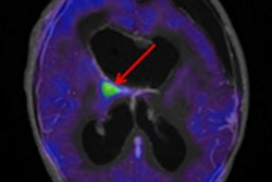 2019 02 01 18 58 8212 Pet Mri Pedx Jnm Marner Thumb