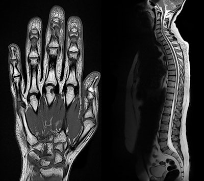 MR images acquired on the Magnetom Sola 1.5-tesla system. Images courtesy of Siemens Healthineers.