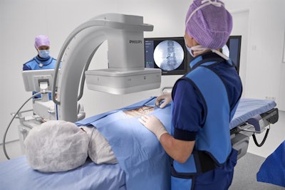Zenition brings Philips' Azurion technology to the C-arm segment. Image courtesy of Philips.