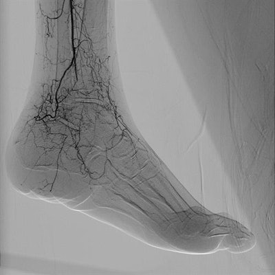 Fine details are visible with the Azurion 7 interventional system. Image courtesy of Philips Healthcare.