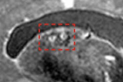 2019 02 27 22 27 4018 2019 02 28 7 T Mri2 20190228192937