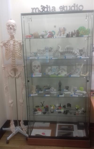 3D-printed models in the media studio at Addenbrooke's Hospital in Cambridge. All images courtesy of Dr. Karen Eley.