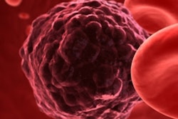 2019 04 05 16 58 5171 Cancer Cell 400