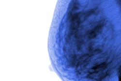 2018 12 17 22 16 3571 Breast Cancer2 400