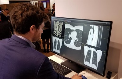 GE's Bone VCAR algorithm identifies vertebrae on CT images.