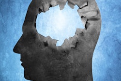 2019 03 09 00 23 4329 Brain2 Hole 400