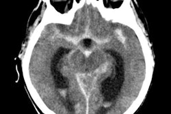 2019 03 20 17 55 2206 10639840 20180412180619 0 20180412180721