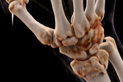 2019 03 20 21 51 5808 Cin Rendering Kantonsspital Figure2 400