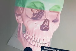 2019 03 20 22 21 2545 Ar Cranium 20190320225106