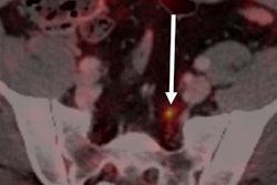 2019 03 22 22 08 8797 2019 03 25 Ga 68 Psma Petct Prostate Cancer Sawicki 20190322222738