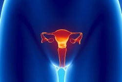 2019 04 01 17 25 4964 Uterus Cervix 400