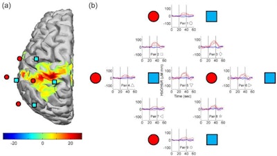 (a) fNIRS probe positions superimposed on a fMRI t-stat map. (b) Averaged fNIRS data; oxyhemoglobin are the red lines. Hemodynamic changes consistently overlapped with fMRI data.