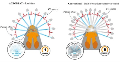 Left: Patient-connected imaging with ACROBEAT. The gantry trajectory and timing of the projection acquisition are adapted to the patient's ECG signal (red) as it evolves in real-time. Right: Conventional multisweep retrospectively ECG-gated acquisition. The gantry trajectory and timing of the projection acquisition are constant throughout the duration of the scan. Image courtesy of Reynolds et al, Phys Med Biol, 10.1088/1361-6560/ab03f4.