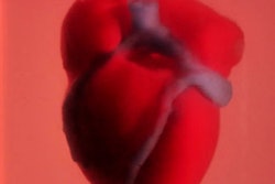 2019 04 22 16 34 7210 3 D Bioprinted Heart 400