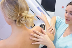 2019 04 29 23 26 5692 Mammogram Breast 400