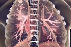 2019 05 01 23 33 9001 Tuberculosis Lungs 400