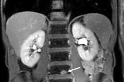 2019 05 09 18 12 5837 Taylor Streamline Case 400