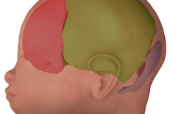 2019 05 15 16 53 5403 3 D Mri Brain 400