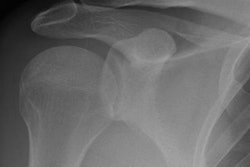 2019 05 15 19 59 6687 10639840 20171103180937 3 20171103181424