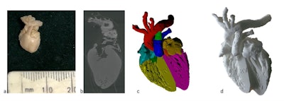 3D printing from micro-CT of a 16-week gestation fetal heart. (a) External appearances of the fetal heart, measuring less than 1 cm in length; (c) virtual 3D volume-rendered micro-CT imaged model with cardiac segments color coded. The final 3D-printed model (d) was resized to 10 x 10 x 10 of the original dimensions for use as an educational tool. Courtesy of Shelmerdine SC et al. 3D printing from microfocus computed tomography (micro-CT) in human specimens: education and future implications. Br J Radiol. 2018;91(1088). doi:10.1259/bjr.20180306.