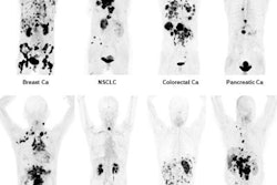 2019 06 27 16 40 8470 Snmmi 2019 Image Of The Year Giesel Final 20190627161124