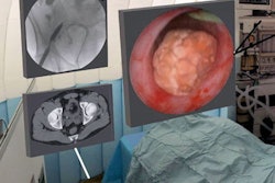2019 06 28 18 20 8460 Ar Ct Endoscopy 400