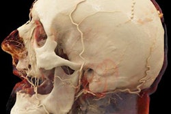 2019 07 01 22 28 0424 Cr Head 20190701225054