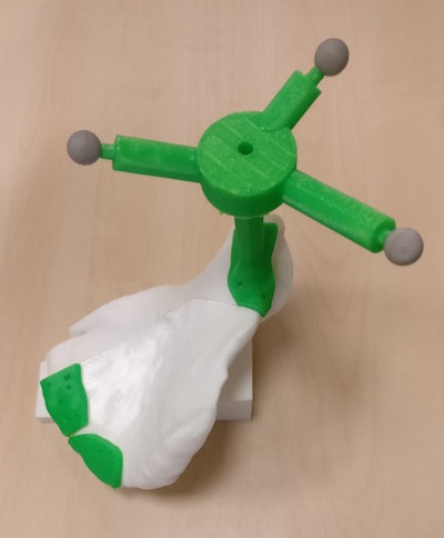 3D-printed surgical guide and template (green) attached to the pelvic bone (white) for simulating pelvic tumor resection. Image courtesy of Mónica García-Sevilla.