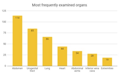 Bar graph of most frequently examined organs, from abdomen as the most to extremities as the least