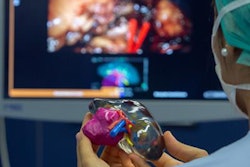 2019 07 16 17 09 3025 2016 07 16 3 D Printed Kidney 20190716174649