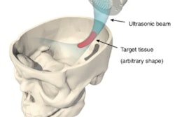 2019 08 07 23 22 7719 Hologram Diagram 400