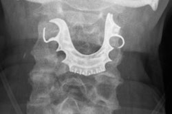 2019 08 13 17 56 4416 Bmj Dentures X Ray 20190813163806