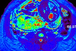 2019 08 13 18 39 0800 Placenta Figure1 B 20190813182507