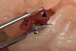 2019 08 15 16 03 9502 2019 08 16 3 D Printing Neurosurgery