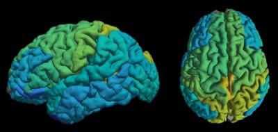 The quantitative MRI technique provides a molecular map of different areas in the brain. Image courtesy of Shir Filo/Hebrew University.