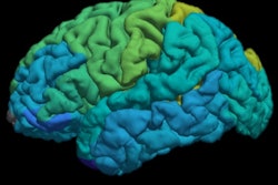 2019 08 20 18 51 7221 Mezer Mri Brain Map Thumb