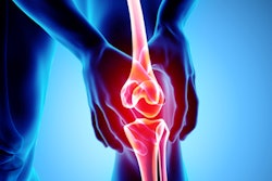 2019 08 26 16 58 9033 Knee Pain Xray 400