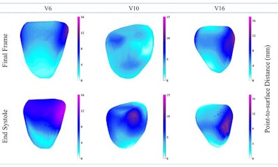 Comparison of heart muscle displacement in the left ventricles of three patients (V6, V10, V16) as calculated on 3D MRI. Image courtesy of the WMG at the University of Warwick.