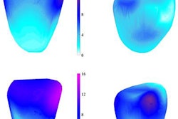 2019 08 29 00 07 3748 2019 08 29 3 D Cardiac Mri 20190829001548